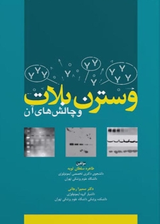 عکس وسترن بلات و چالش های آن