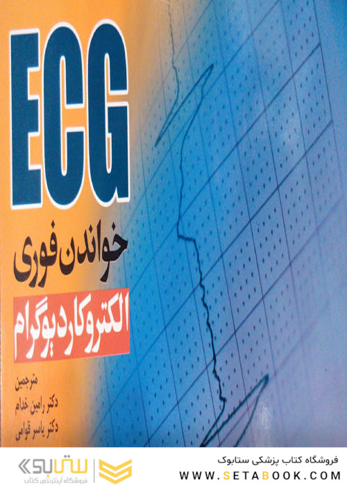 ECG خواندن فوری الکتروکاردیوگرام