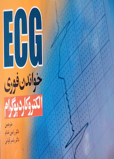عکس ECG خواندن فوری الکتروکاردیوگرام