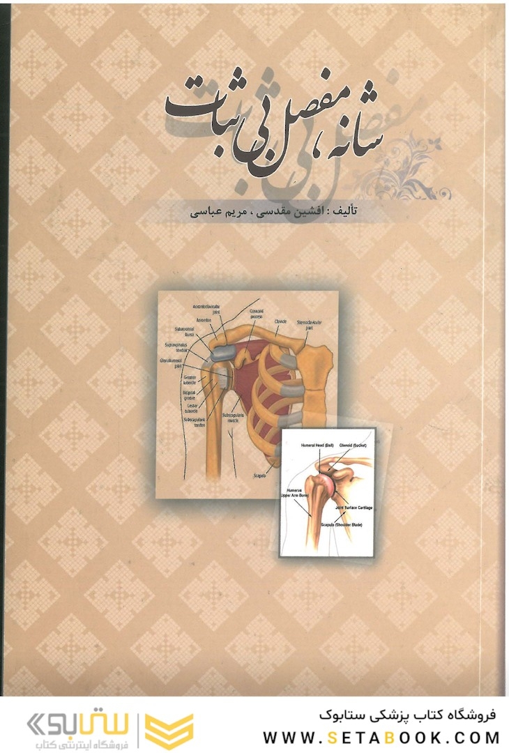 شانه مفصل بی ثبات