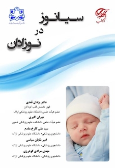 عکس سیانوز در نوزادان