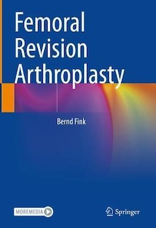 عکس Femoral Revision Arthroplasty