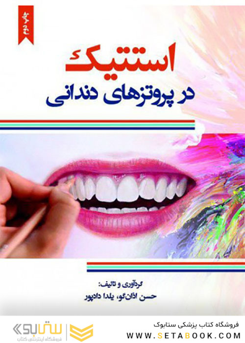 استتیک در پروتزهای دندانی