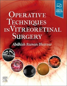عکس Operative Techniques in Vitreoretinal Surgery