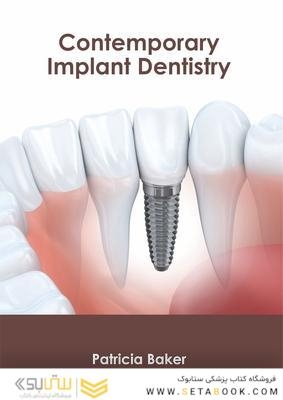 Contemporary Implant Dentistry