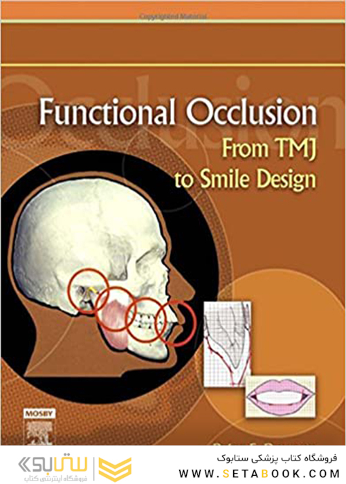 Functional Occlusion: From TMJ to Smile Design