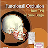 Functional Occlusion: From TMJ to Smile Design