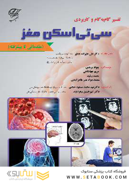 تفسیر گام به گام و کاربردی سی تی اسکن مغز (مقدماتی تا پیشرفته)