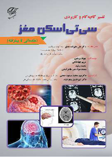 عکس تفسیر گام به گام و کاربردی سی تی اسکن مغز (مقدماتی تا پیشرفته)