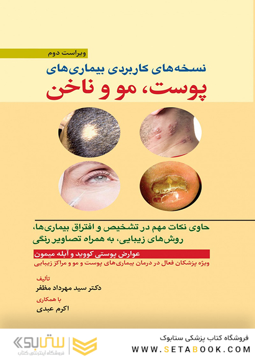 نسخه  های کاربردی بیماری  های پوست، مو و ناخن
