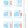 Botulinum Toxin in Facial Rejuvenation 2nd Edición