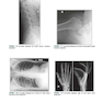 Radiographic Image Analysis