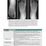 Radiographic Image Analysis