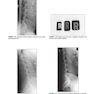 Radiographic Image Analysis
