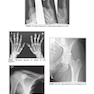 Radiographic Image Analysis