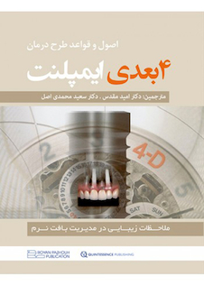 عکس اصول و قواعد طرح درمان 4 بعدی ایمپلنت ملاحظات زیبایی در مدیریت بافت نرم