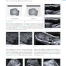 Ultrasound Teaching Manual: The Basics of Performing and Interpreting Ultrasound Scans 4th Edicion