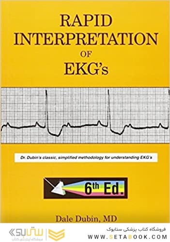 EKG Rapid Interpretation of EKG