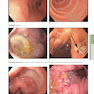 HARRISONS PRINCIPLES OF INTERNAL MEDICINE Part Disorders Of the Gastrointestinal System