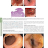 HARRISONS PRINCIPLES OF INTERNAL MEDICINE Part Disorders Of the Gastrointestinal System