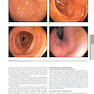 HARRISONS PRINCIPLES OF INTERNAL MEDICINE Part Disorders Of the Gastrointestinal System