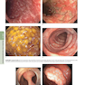 HARRISONS PRINCIPLES OF INTERNAL MEDICINE Part Disorders Of the Gastrointestinal System