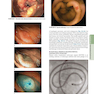 HARRISONS PRINCIPLES OF INTERNAL MEDICINE Part Disorders Of the Gastrointestinal System