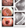 HARRISONS PRINCIPLES OF INTERNAL MEDICINE Part Disorders Of the Gastrointestinal System