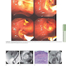 HARRISONS PRINCIPLES OF INTERNAL MEDICINE Part Disorders Of the Gastrointestinal System