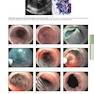 HARRISONS PRINCIPLES OF INTERNAL MEDICINE Part Disorders Of the Gastrointestinal System