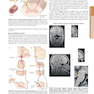 HARRISONS PRINCIPLES OF INTERNAL MEDICINE Part Cardinal Manifestations and Presentation Of Disease