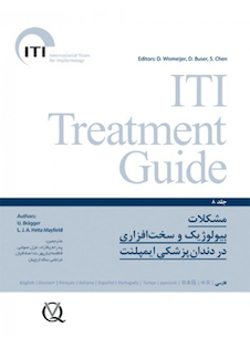 عکس مشکلات بیولوژیک و سخت افزاری در دندانپزشکی ایمپلنت  ITI