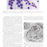 Williams Hematology: The Red Cell and Its Diseases