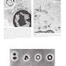 Williams Hematology: The Red Cell and Its Diseases