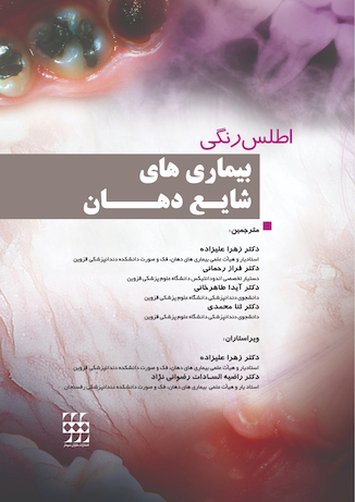 عکس اطلس رنگی بیماری های شایع دهان