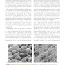 Pleural Diseases