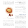 بی حسی موضعی مالامد 2020