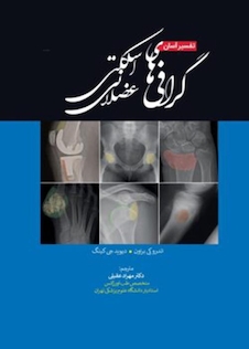 عکس تفسیر آسان گرافی های اسکلتی عضلانی 2021