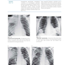 Clinical Imaging: An Atlas of Differential Diagnosis Fifth Edition