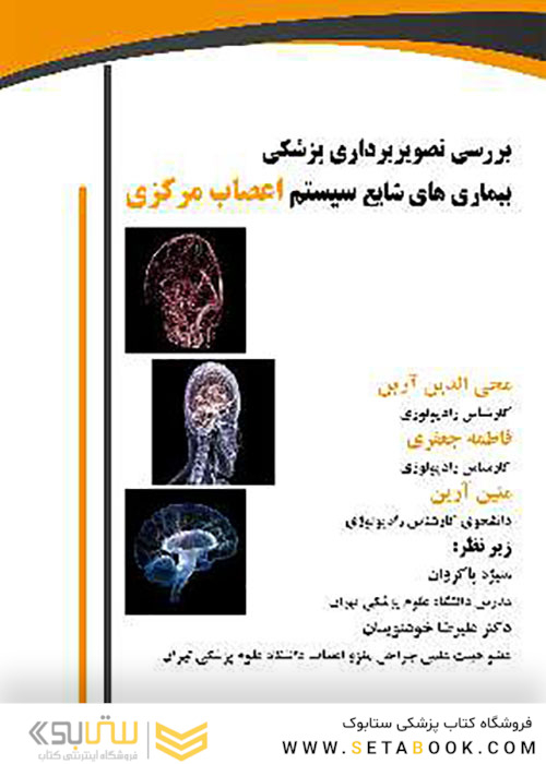 بررسی تصویربرداری پزشکی بیماری های شایع سیستم اعصاب مرکزی