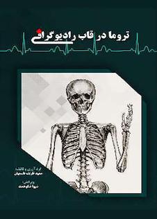 عکس تروما در قاب رادیوگرافی