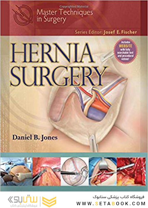 کتاب Master Techniques in Surgery: Hernia