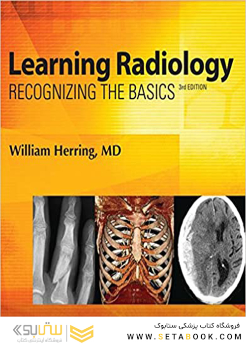 Learning Radiology: Recognizing the Basics