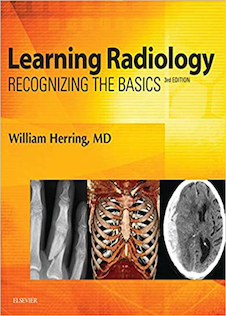 عکس Learning Radiology: Recognizing the Basics