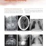 Learning Radiology: Recognizing the Basics