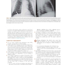 Learning Radiology: Recognizing the Basics