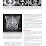 Learning Radiology: Recognizing the Basics