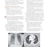 Learning Radiology: Recognizing the Basics