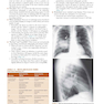 Learning Radiology: Recognizing the Basics