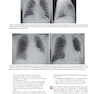 Learning Radiology: Recognizing the Basics